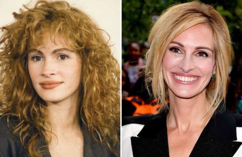 Julia Roberts (avant/après)