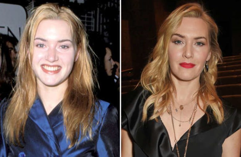 Kate Winslet (avant/après)