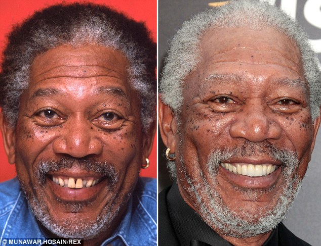 Morgan Freeman (avant/après)