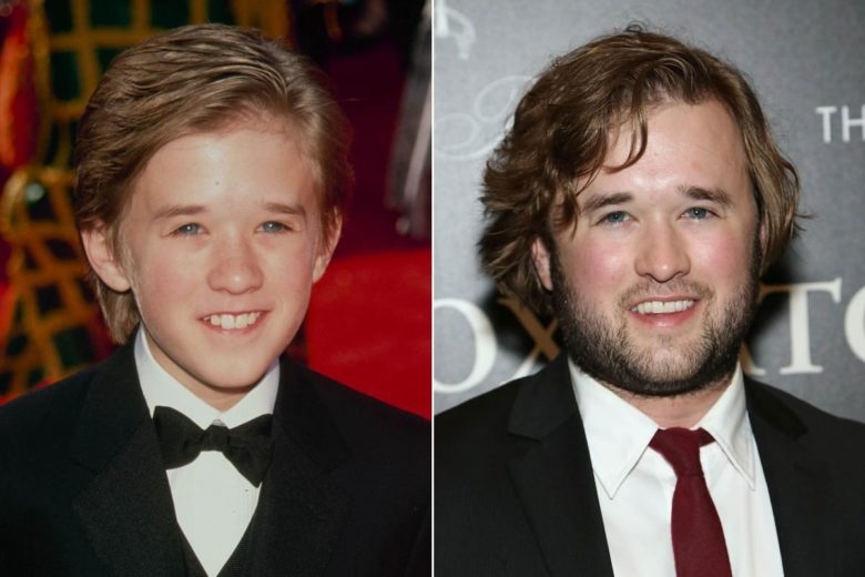 Haley Joel Osment - avant et après