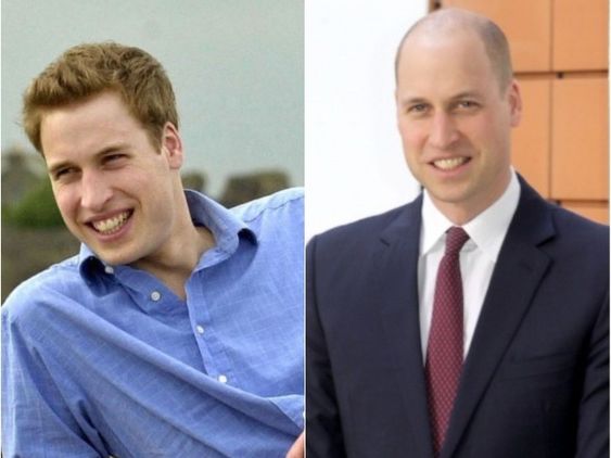 Le prince William - avant et après