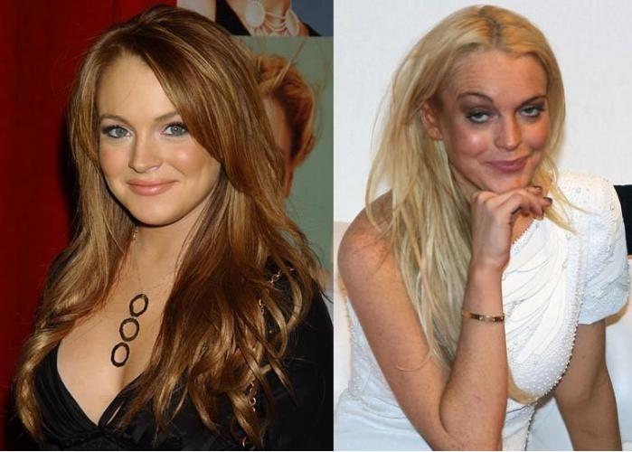 Lindsay Lohan - avant et après
